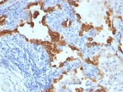 Cytokeratin 8/18 Mouse anti-Human, Clone: SPM192 + SPM265, Novus Biologicals:Antibodies:Primary
